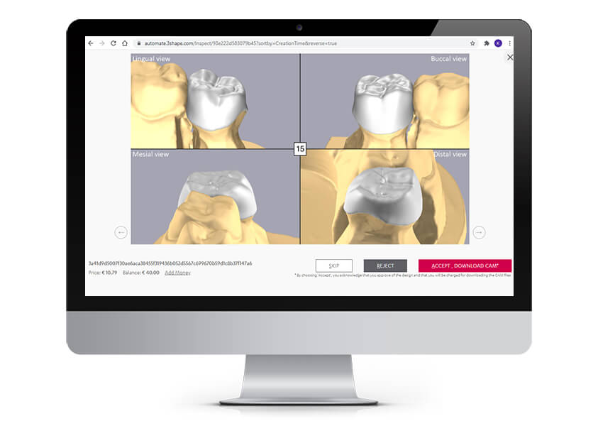 Design with 3Shape Automate