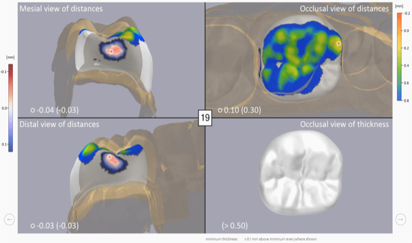3shape Dental System 是集成的cad Cam 技工解决方案