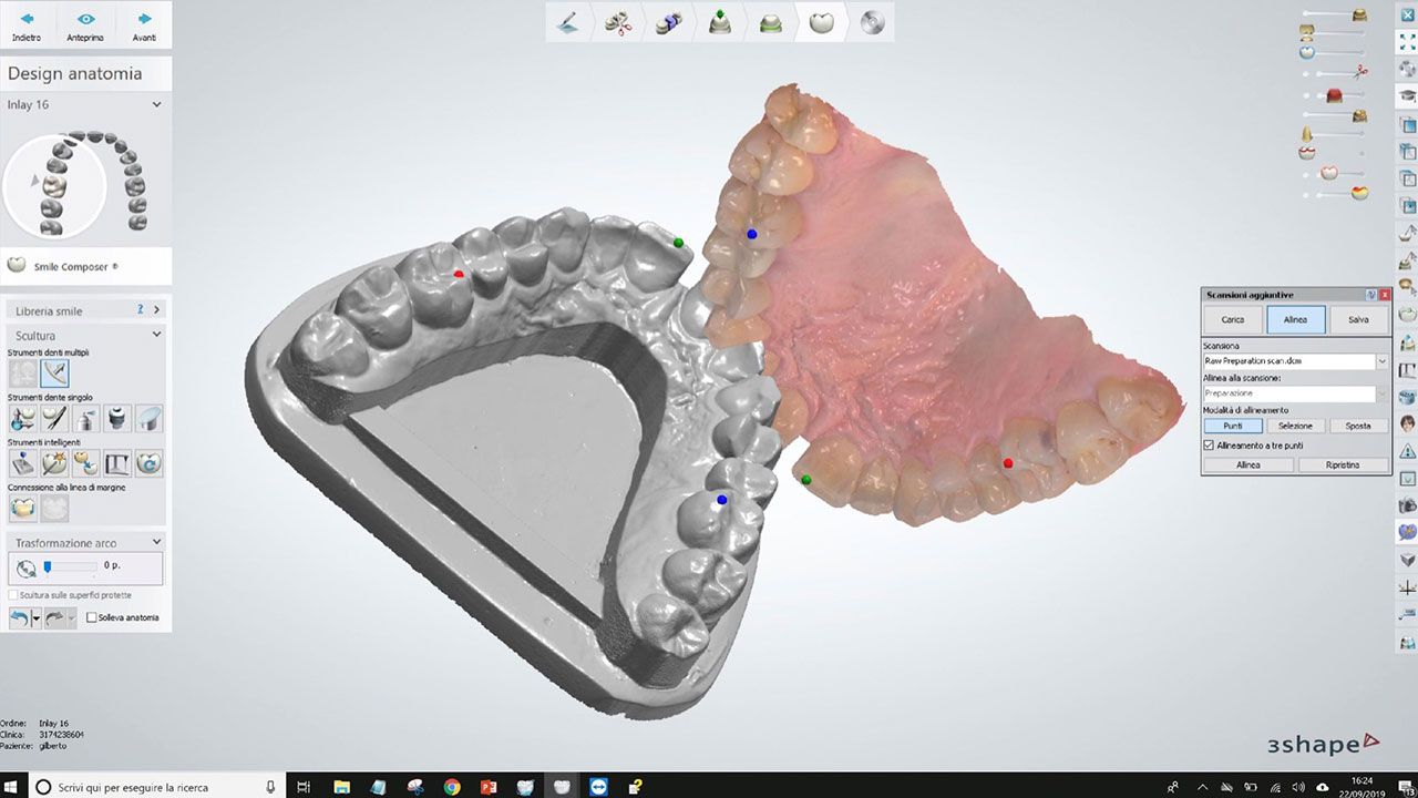 Arco facciale e articolatore analogici