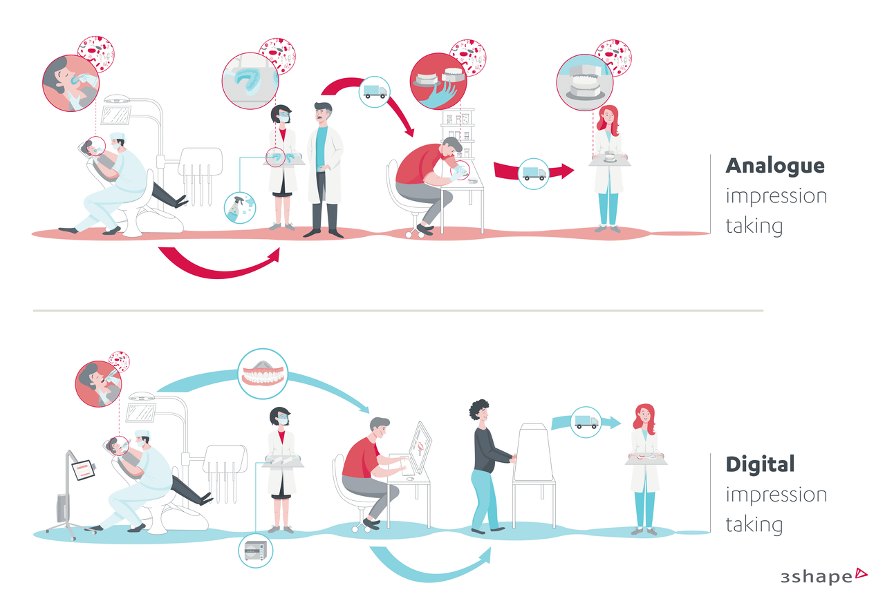 アナログ印象の場合、材料の準備や片づけ、ラボへの輸送など、ワークフローに追加のステップが必要になります。