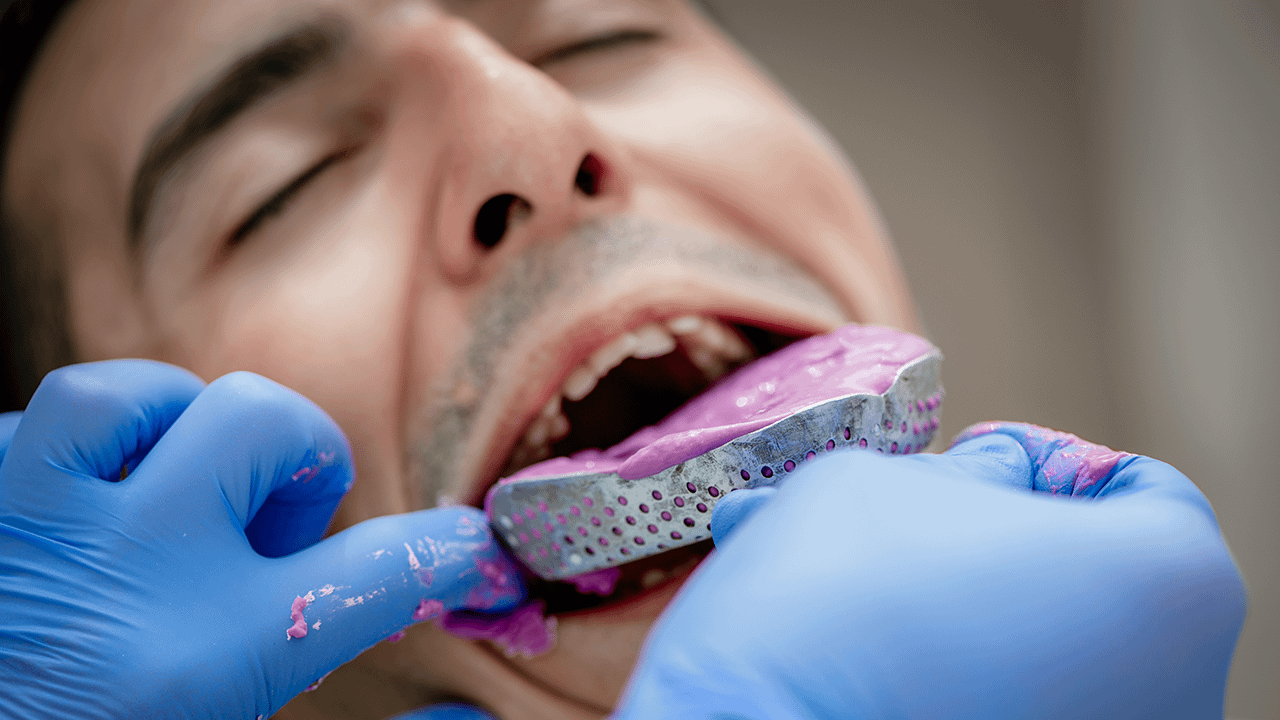 Intraoral scanners make dentist work much easier