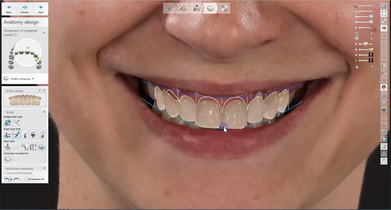 Smooth communication for smile makeover treatments