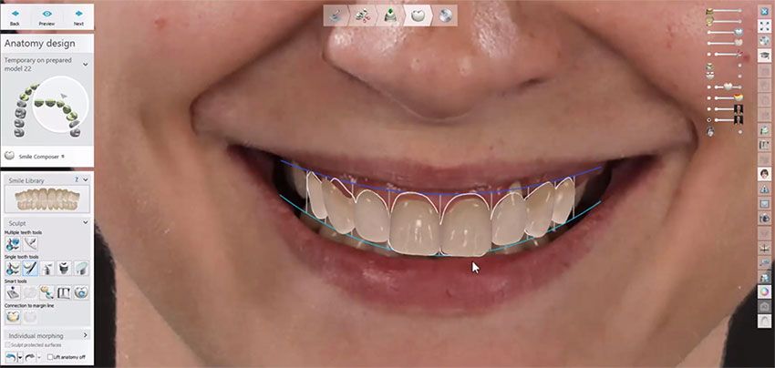 Smile Design improve patient perception