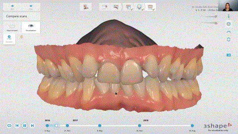 digital representation of patient’s oral health