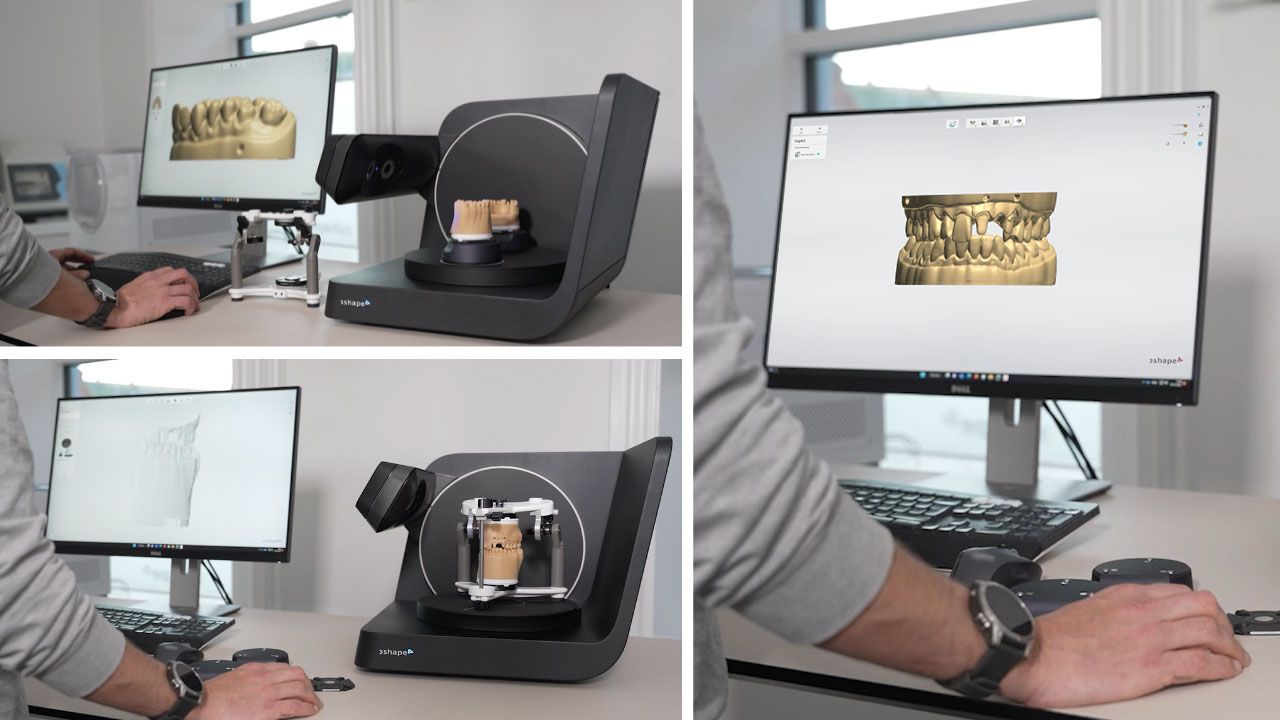 技工所の効率アップを実現するラボスキャナー - 3Shape Blog