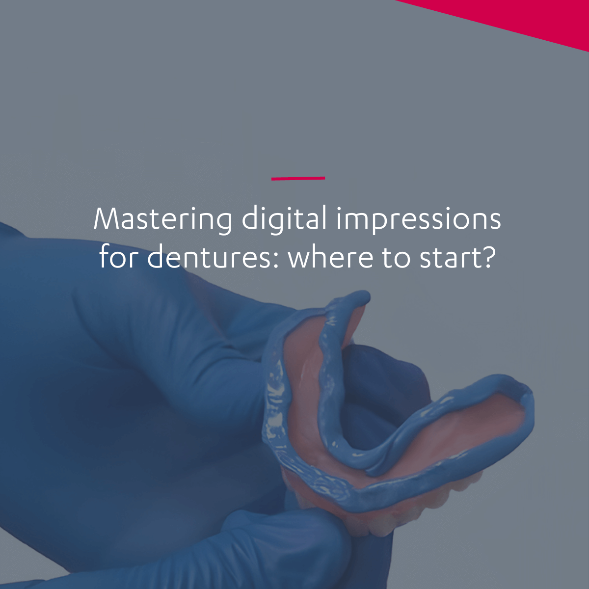 Digital impressions for dentures 3Shape Blog