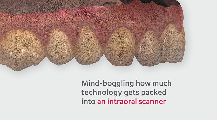 Dentale Intra-oral Scanner 3D Real-time Display Software W Scanning 172012552948 - Foto 9