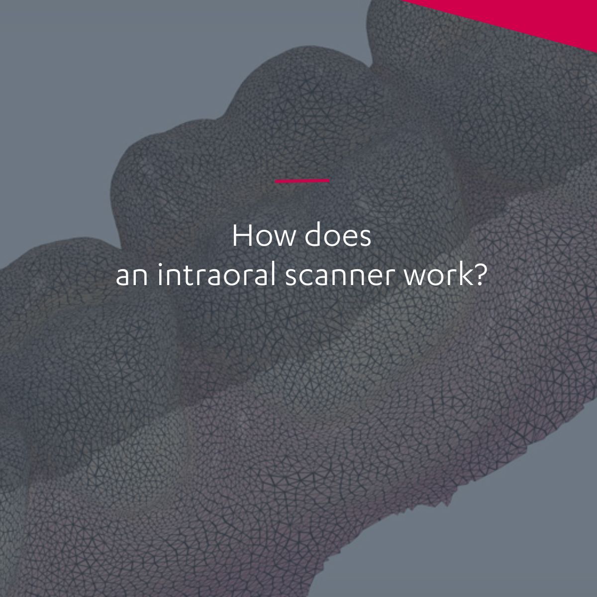 How an intraoral scanner works 3Shape Blog