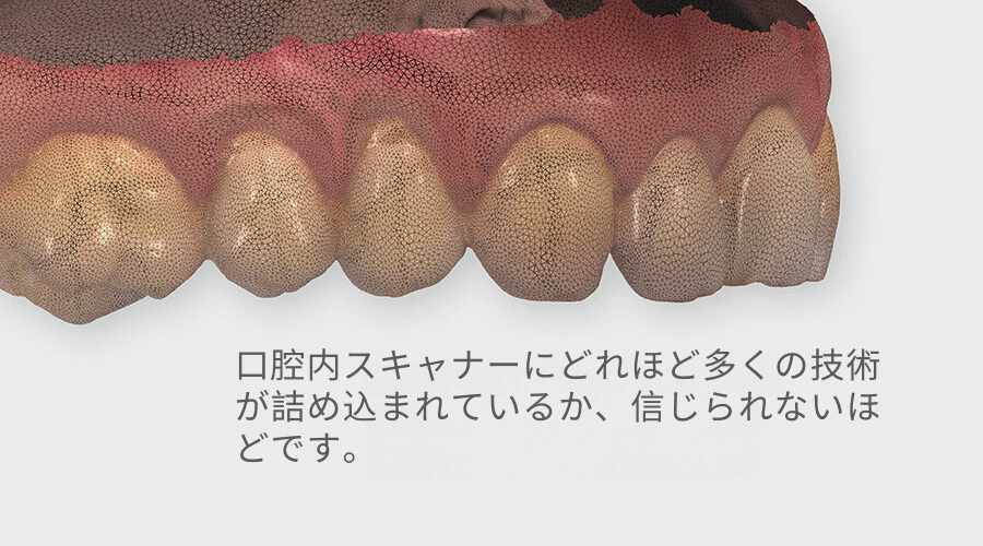 症例から学ぶ口腔内スキャナー　徹底活用 31症例から学ぶ 口腔内スキャナー徹底活用／医歯薬出版株式会社