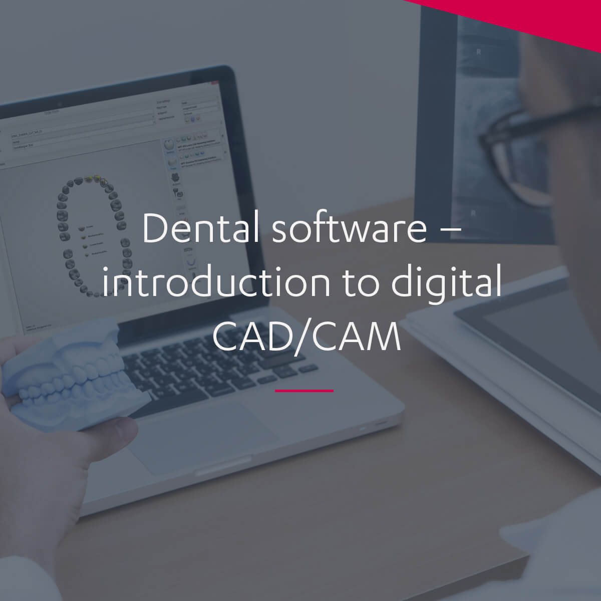 Dental software — introduction to digital CAD/CAM technology – 3Shape Blog