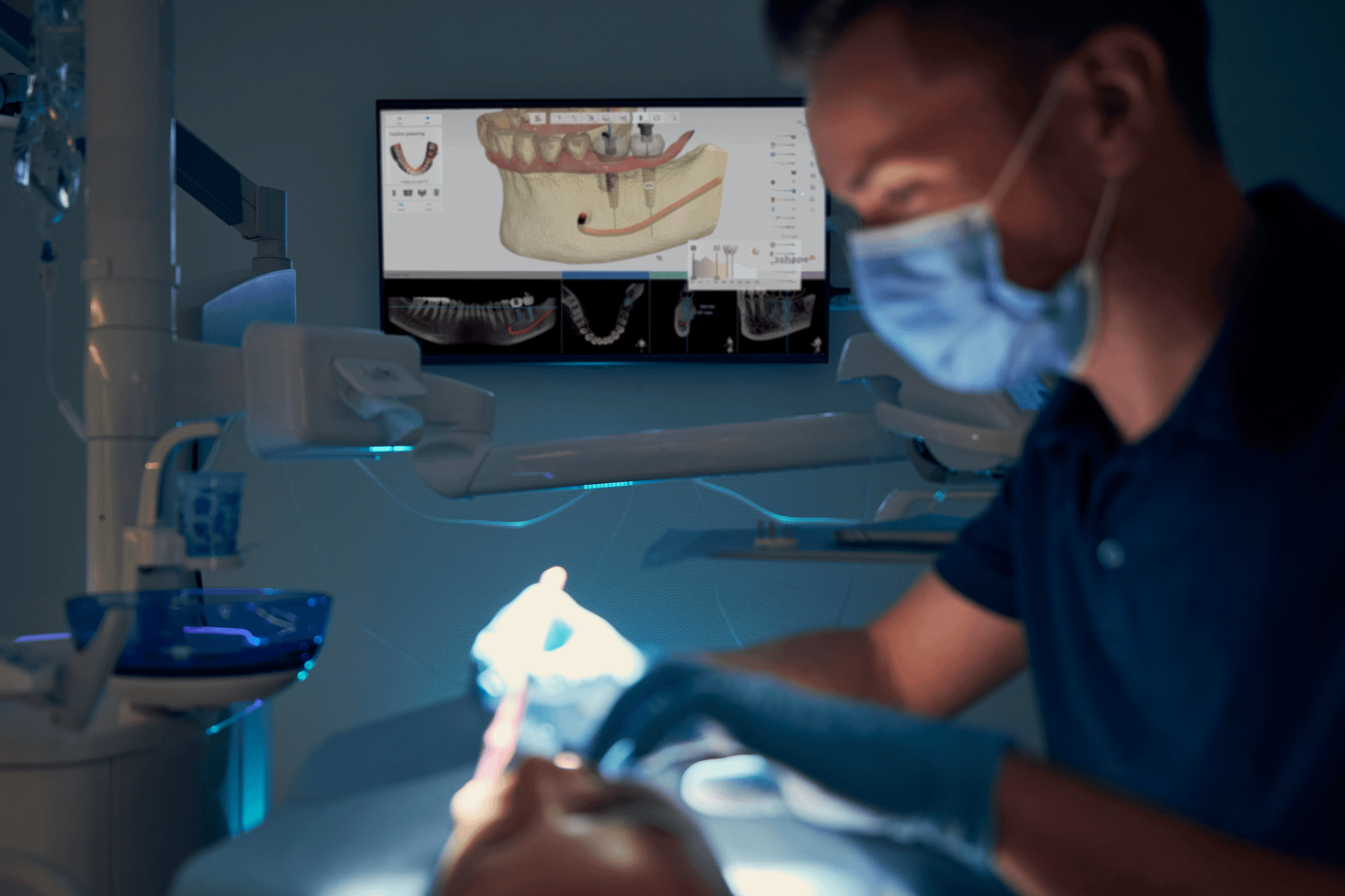 benefits of surgical guides for dental implants