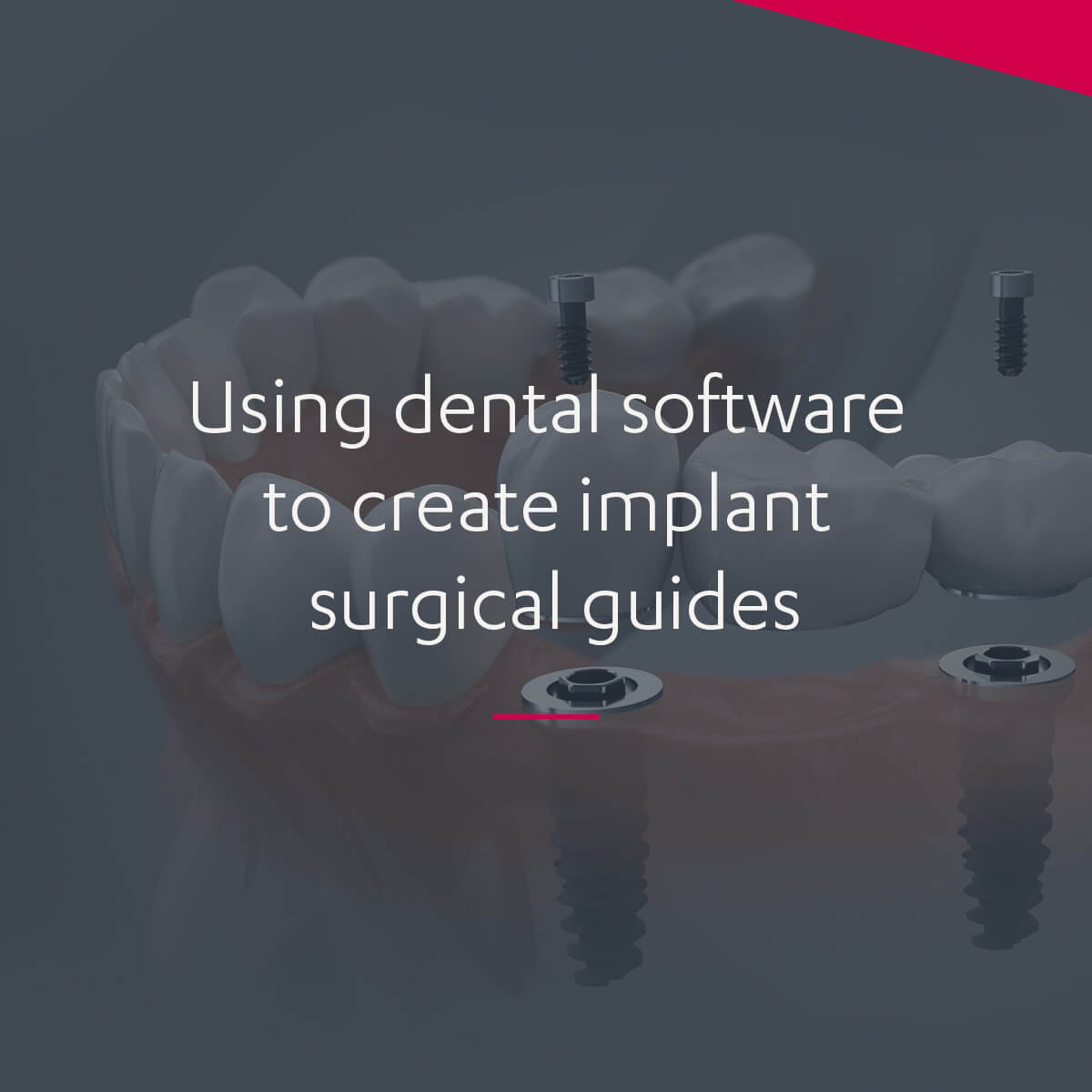 Surgical Guide Machine What is a surgical guide for dental implants – 3Shape Blog
