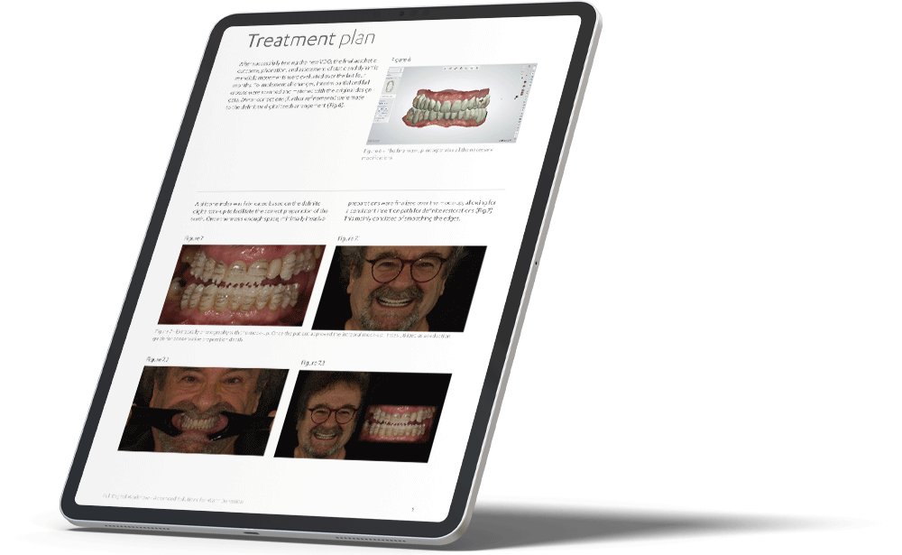  Advanced Solutions for  Worn Dentition iPad