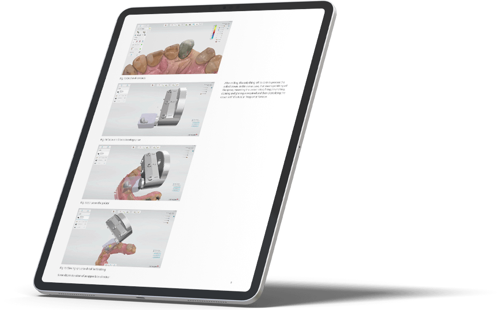 Dental System software on tablet