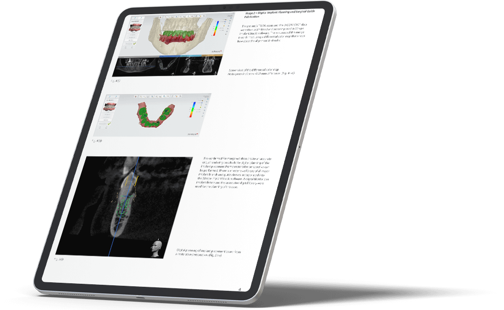 Dental System software on tablet