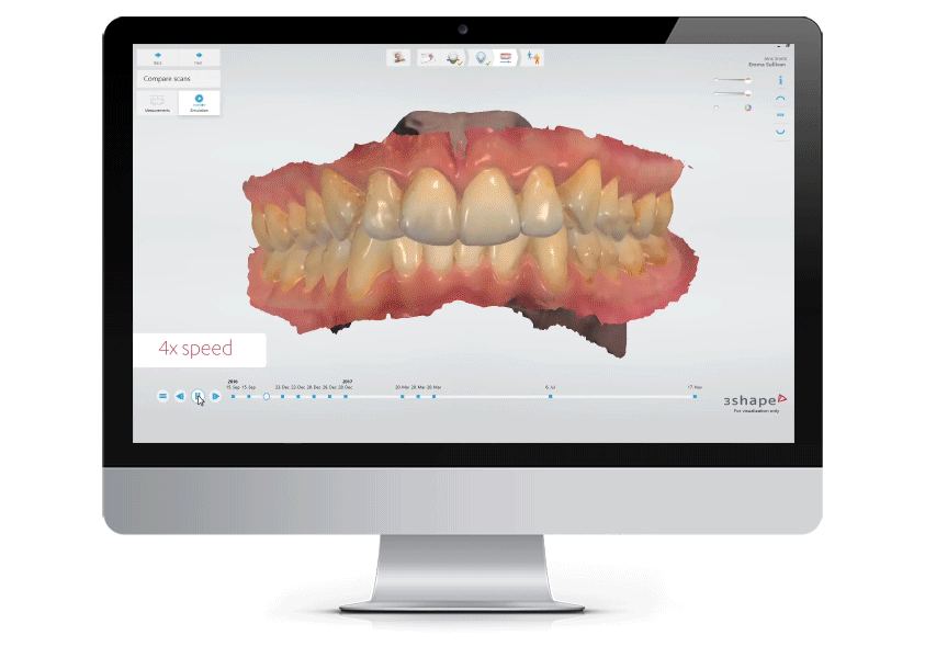 Zenyum scanning gigi
