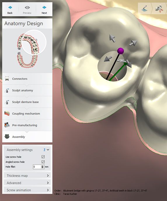 3Shape Dental System | Crack from Reversing Center