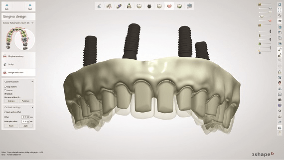 3shape software cost