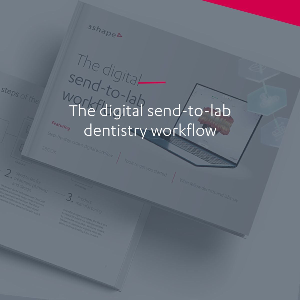 The digital send-to-lab dentistry workflow