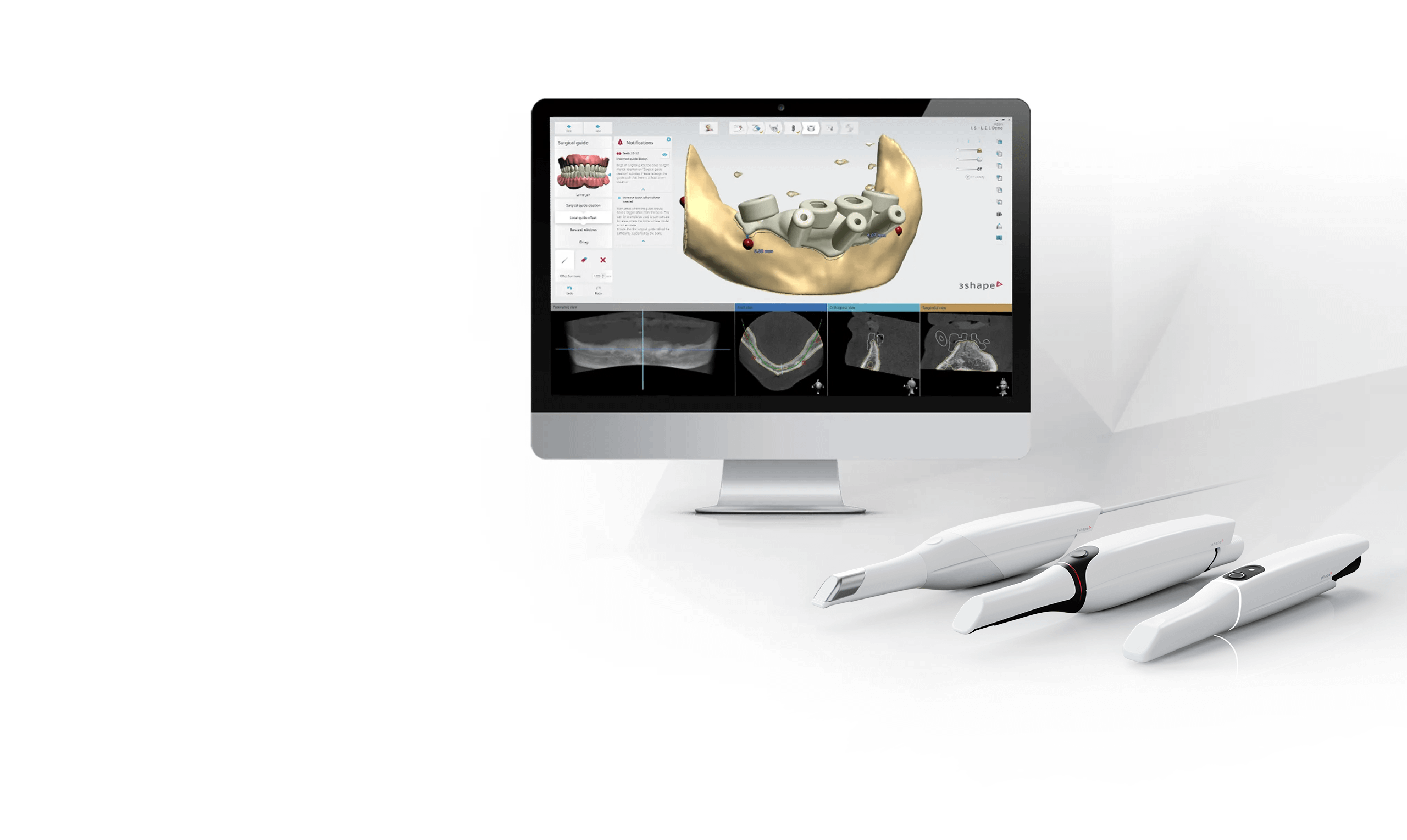 Digitalizzare il flusso di lavoro dentale con il software 3shape