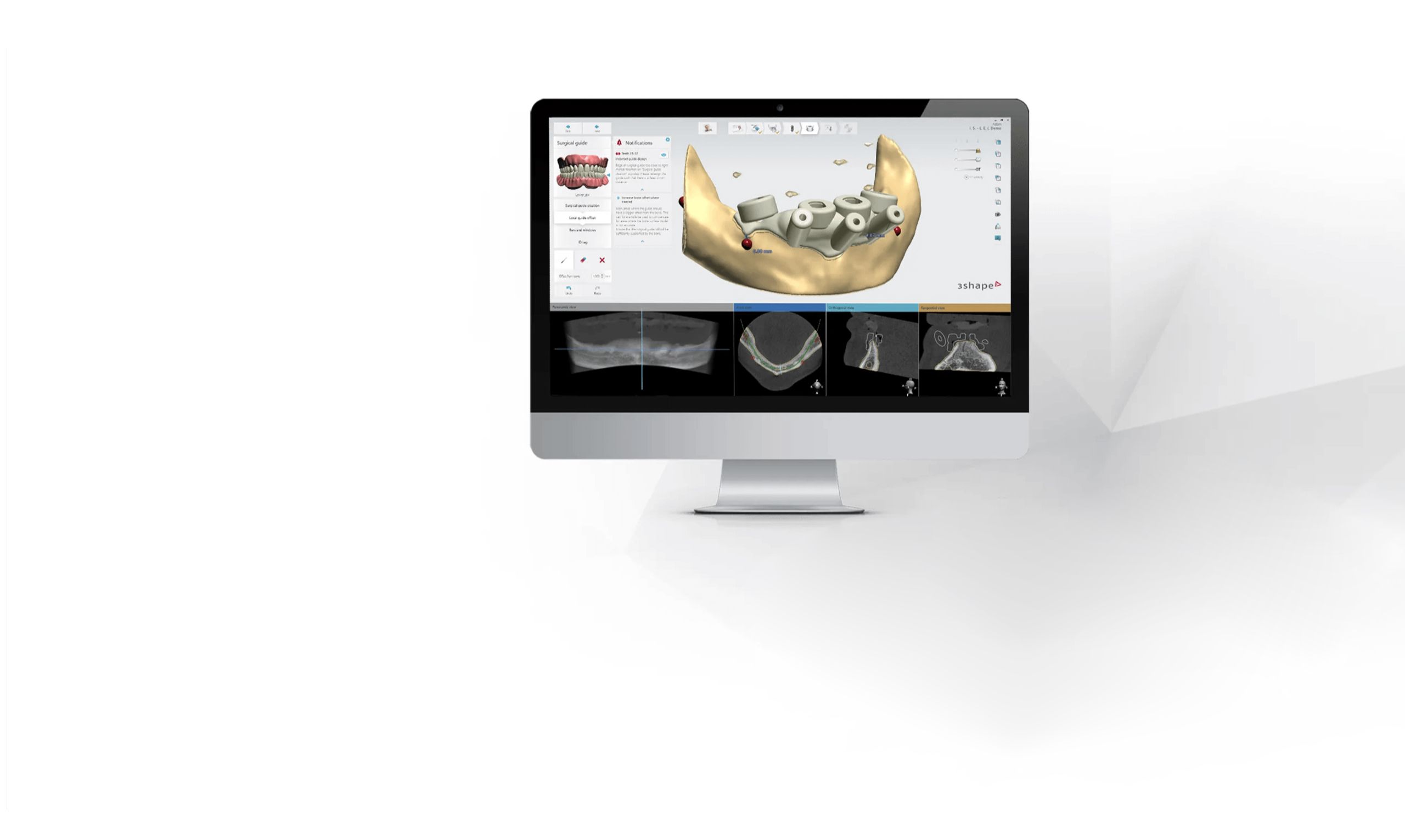 Digitalizzare il flusso di lavoro dentale con il software 3shape