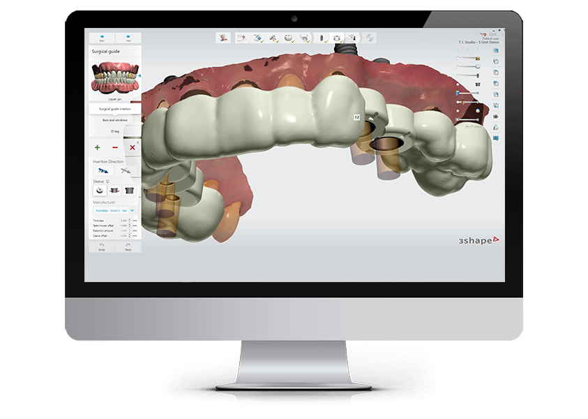 Implant Studio Guided Surgery & Dental Implant Planning Software