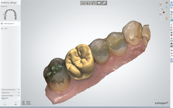 3Shape Dental System 2014
