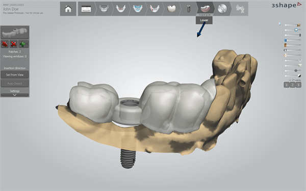 Dental System via 3Shape Communicate