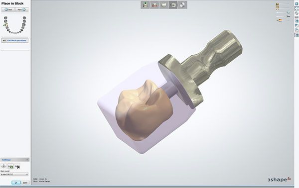 Dental System 2013s new CAD Blocks