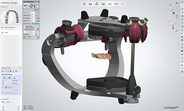 Check dynamic occlusion in the software