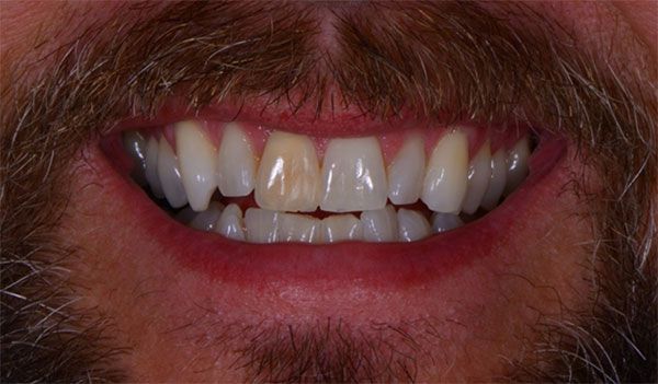 Dentist evaluates img1