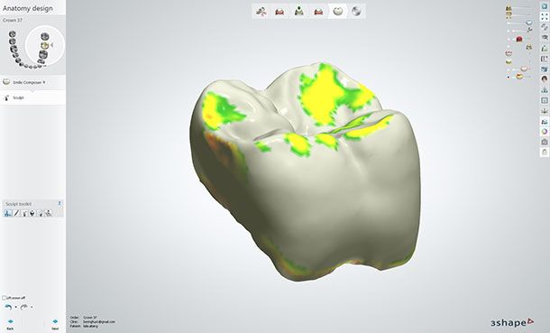 Final design of the model free crown