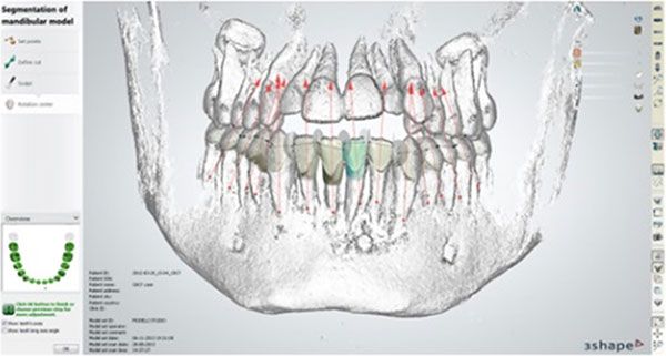 Looking inside Ortho System 2013