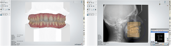 Ortho system 2013