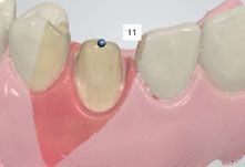 using shade measurement 22