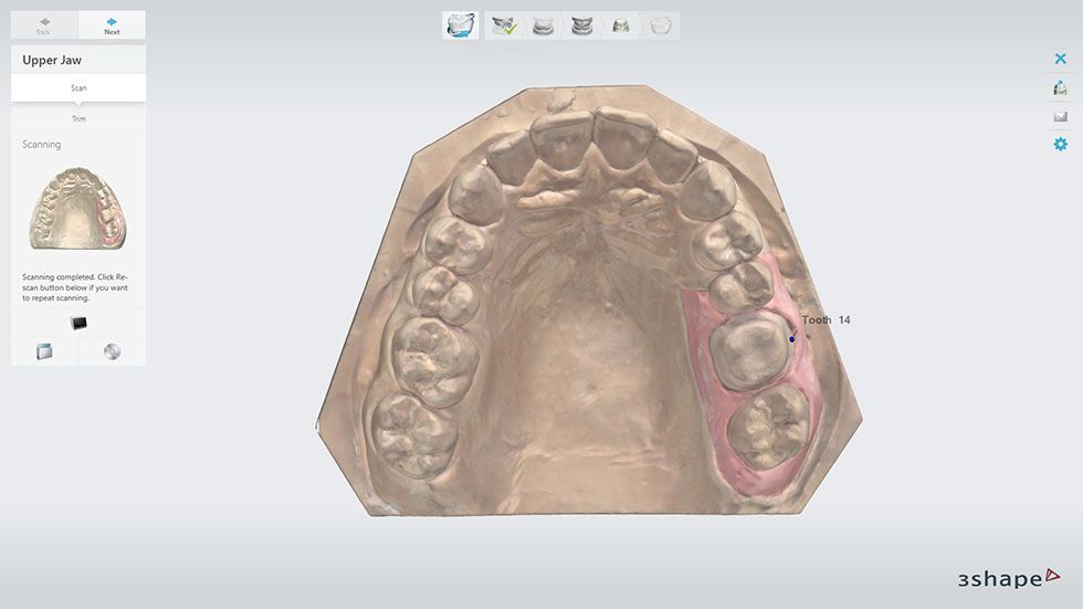 10 ways 3Shape made CADCAM technology so much better