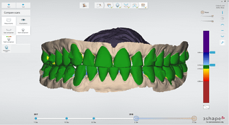 3Shape software updates for dental practices and labs