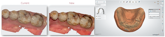 3Shape software updates for dental practices and labs