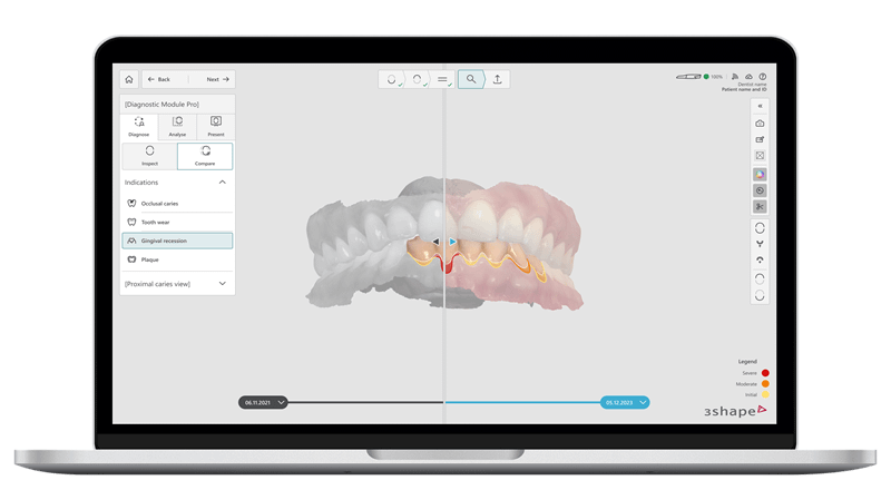 3Shape Receives FDA 510(k) Clearance for 3Shape Dx Software