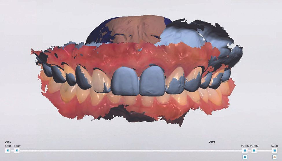 Digital dental monitoring