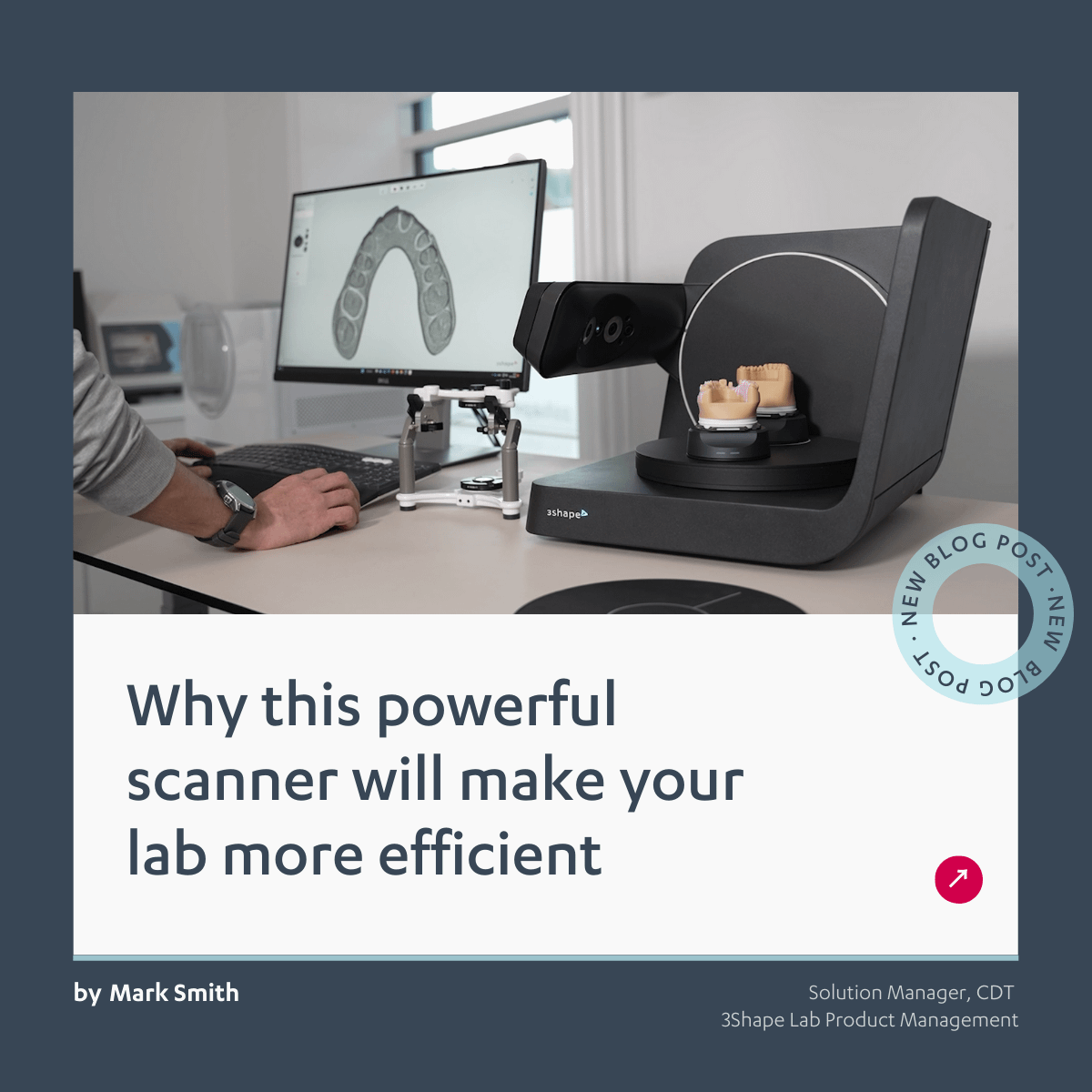 This scanner will make your lab more efficient – 3Shape Blog