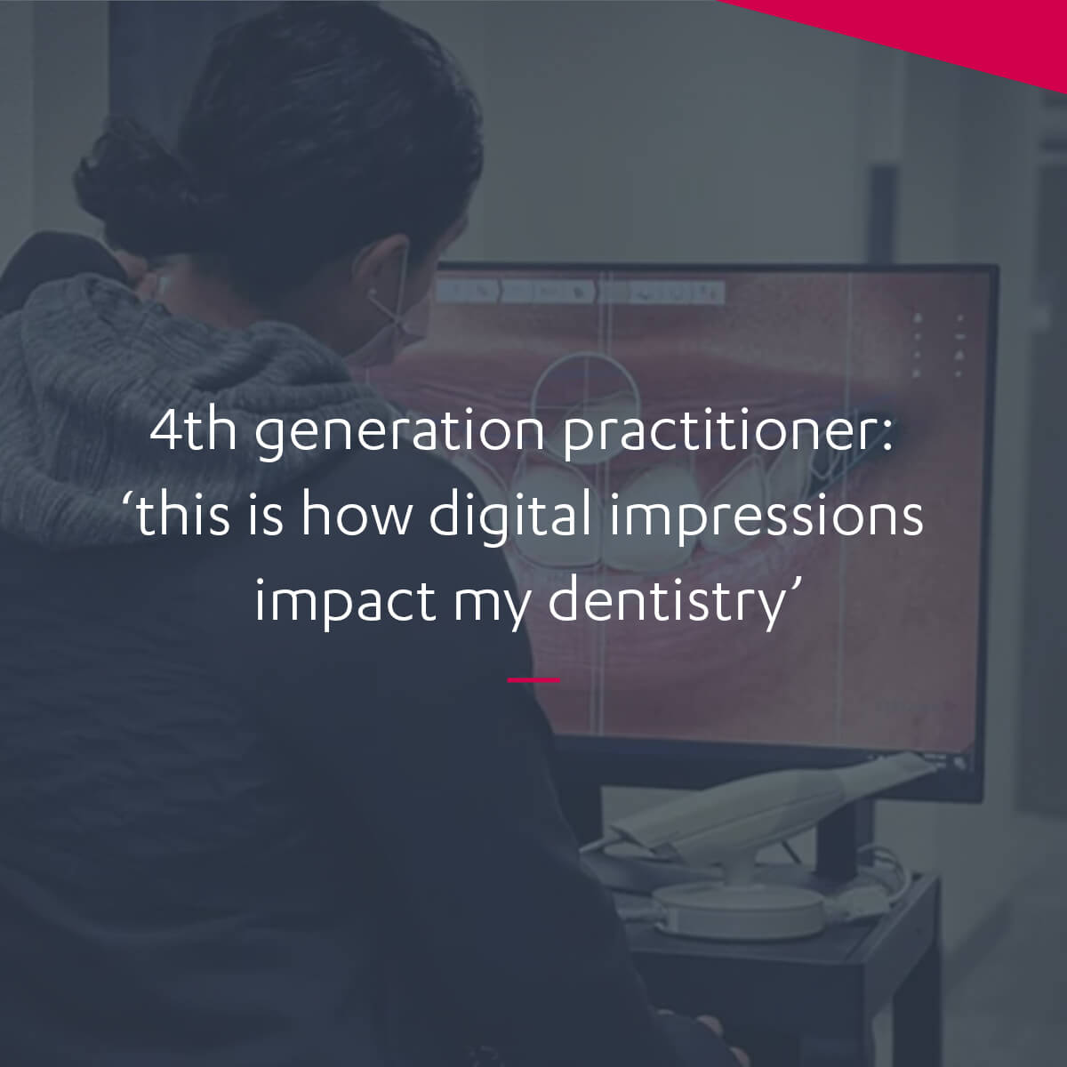 The day-to-day impact of taking impressions digitally – 3Shape Blog