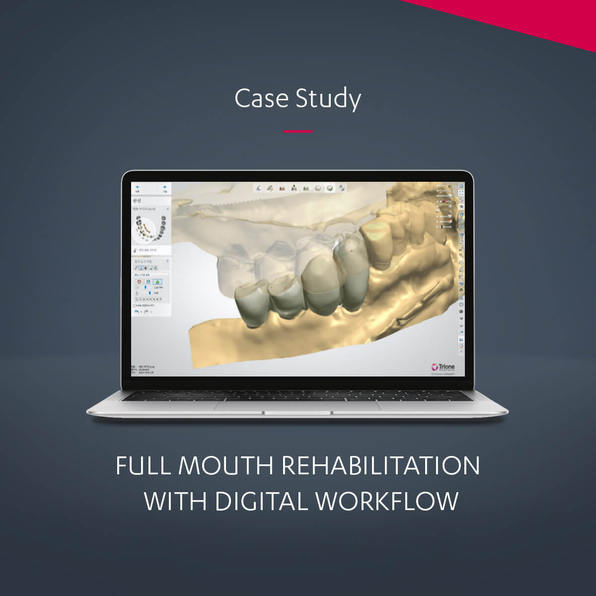 full mouth rehabilitation library dissertation