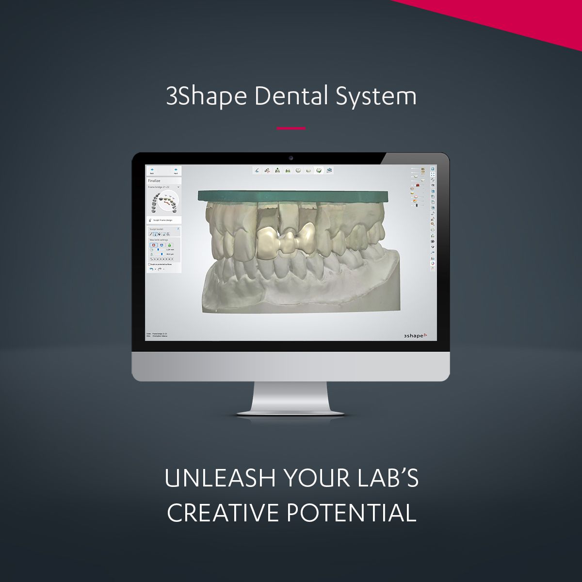 3Shape Dental System® - an Integrated CAD/CAM Solution for Labs