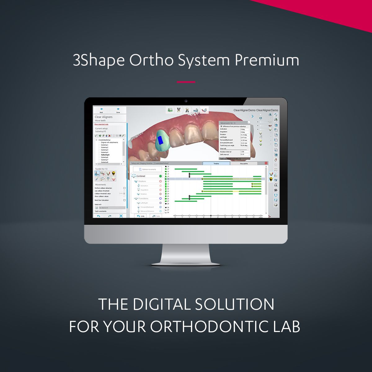 3Shape Ortho System Complete Solution for Digital Orthodontics