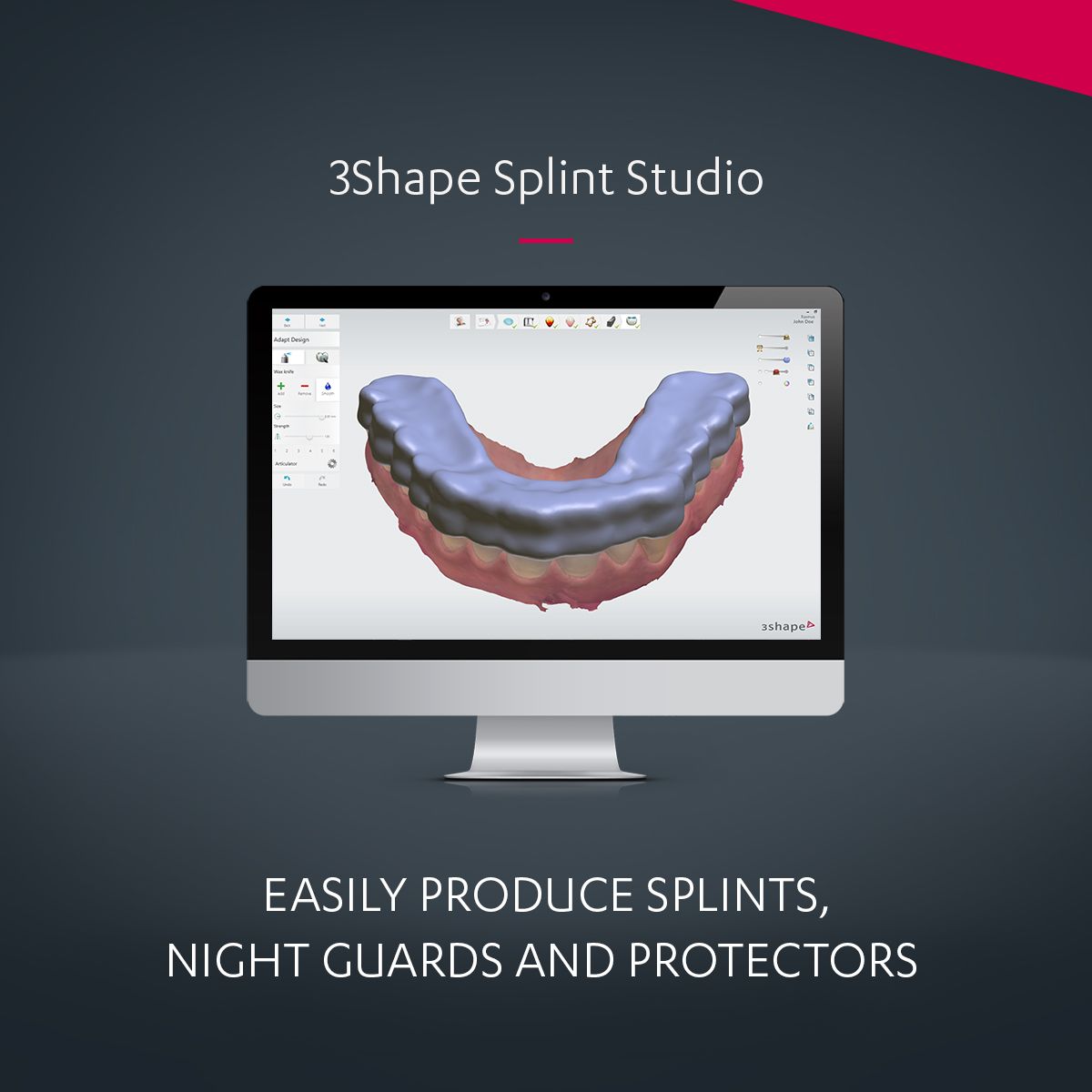 3shape Splints 3Shape Splint Studio: Design key occlusal splint types