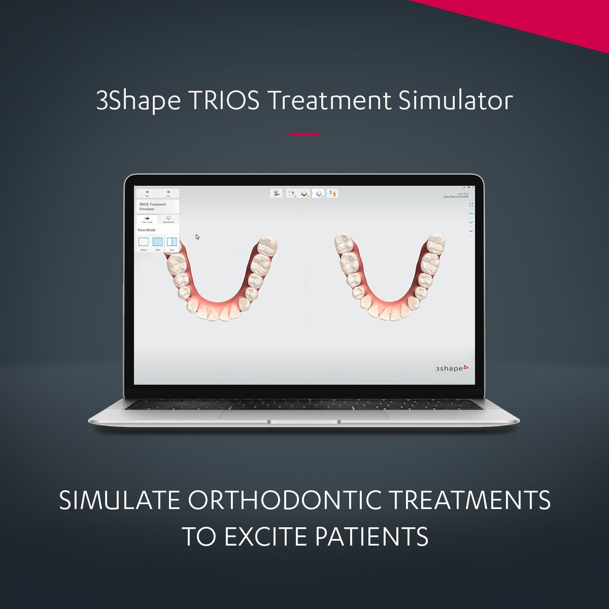 TRIOS Treatment Simulator - Get More Treatment Options - 3Shape