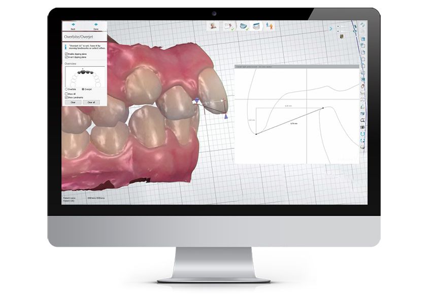 analytic tools for dental clinics and labs