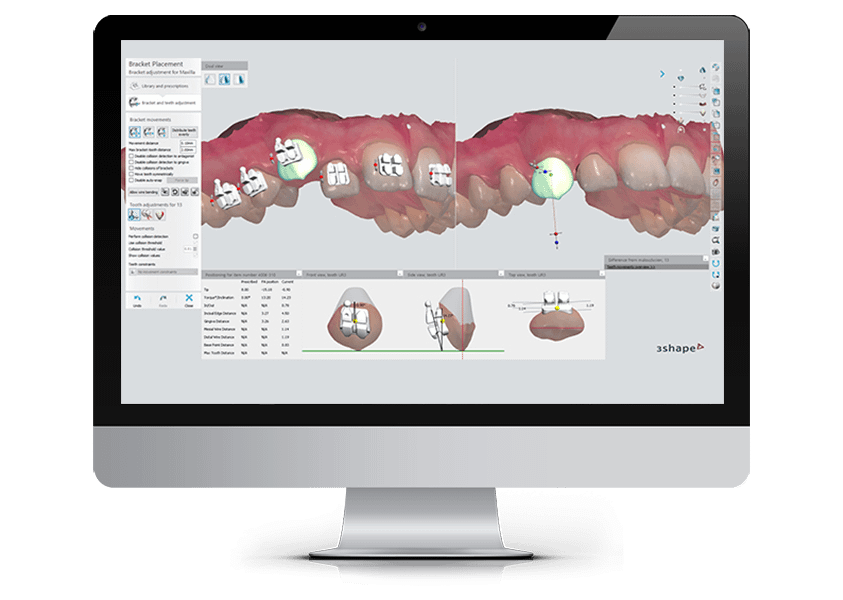 orthodontic computer software