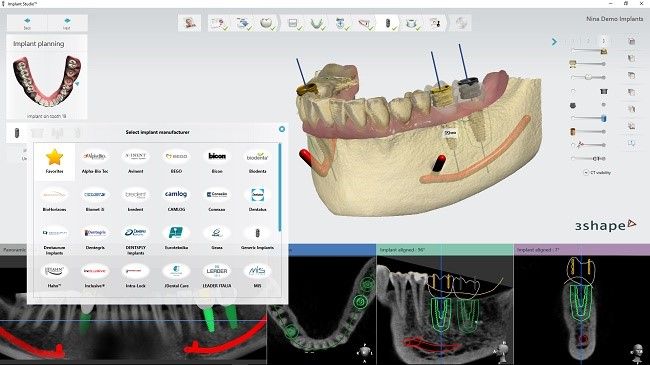 Implant Studio 2016 software
